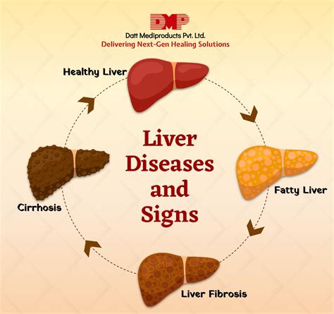 Liver Diseases And Signs Blog By Datt Mediproducts