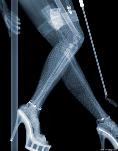 X Ray Voyeurism Nick Veaseys Images Explore What Lies Beneath Pictures Huffpost Uk