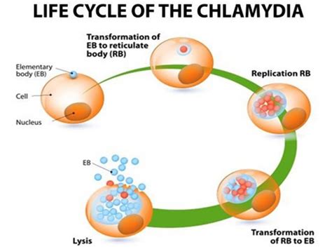 Chlamydia Infection Treatments And Home Remedies Organic Facts