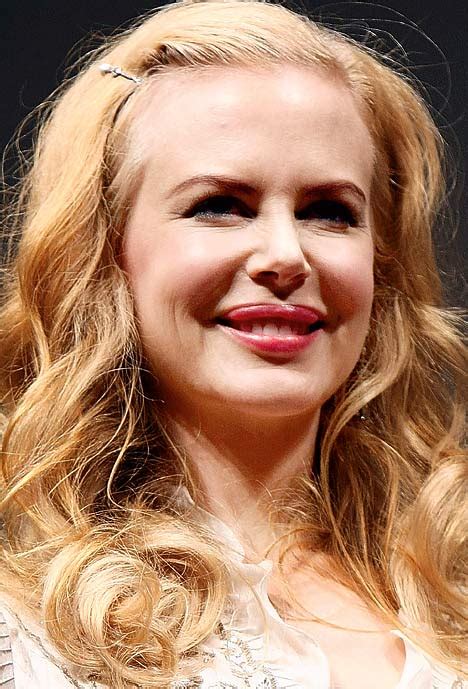 Botox Is Turning Nicole Kidman Into A Bat Face Says Cosmetic Guru