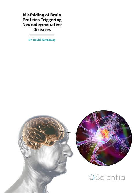 Dr David Westaway Misfolding Of Brain Proteins Triggering Neurodegenerative Diseases