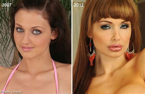 Too Much Plastic Surgery See How Actress Looks Like Now After Years