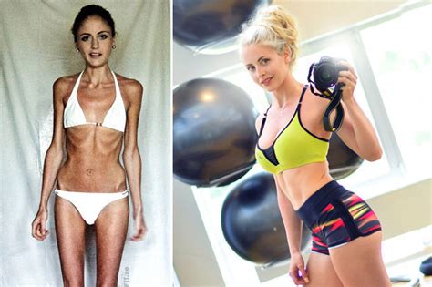 Anorexia Nervosa Sufferer Beats Eating Disorder To Become Weightlifting Sensation Daily Star