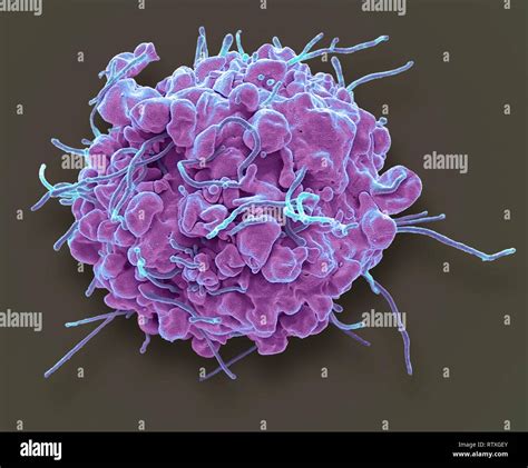 Apoptosis Coloured Scanning Electron Micrograph Sem Of A 293t Cell