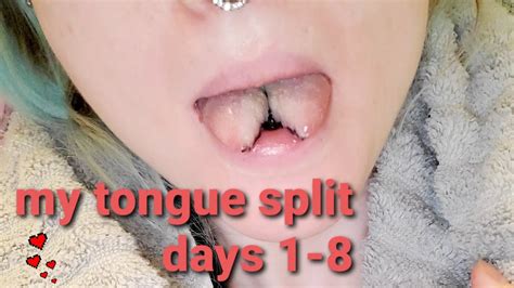 Getting My Tongue Split Days 1 8 Youtube