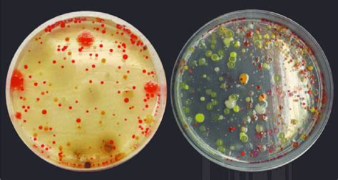 Bacterial Colonies On Agar Plates