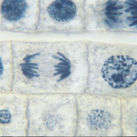 Onion Mitosis Root Tip Microscope Slides Mitosis