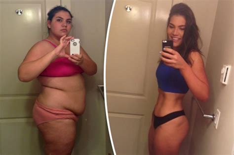 Morbidly Obese Woman Halves Body Weight In 12 Months Without Surgery