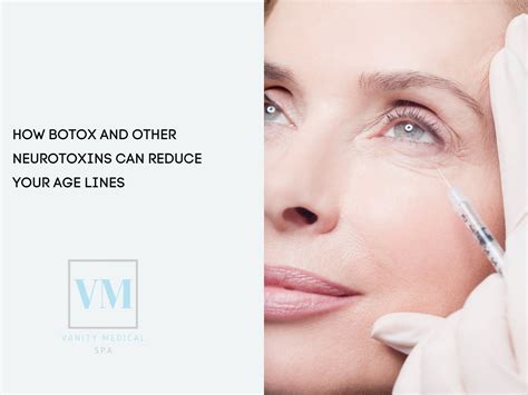 How Botox And Other Neurotoxins Can Reduce Your Age Lines Vanity