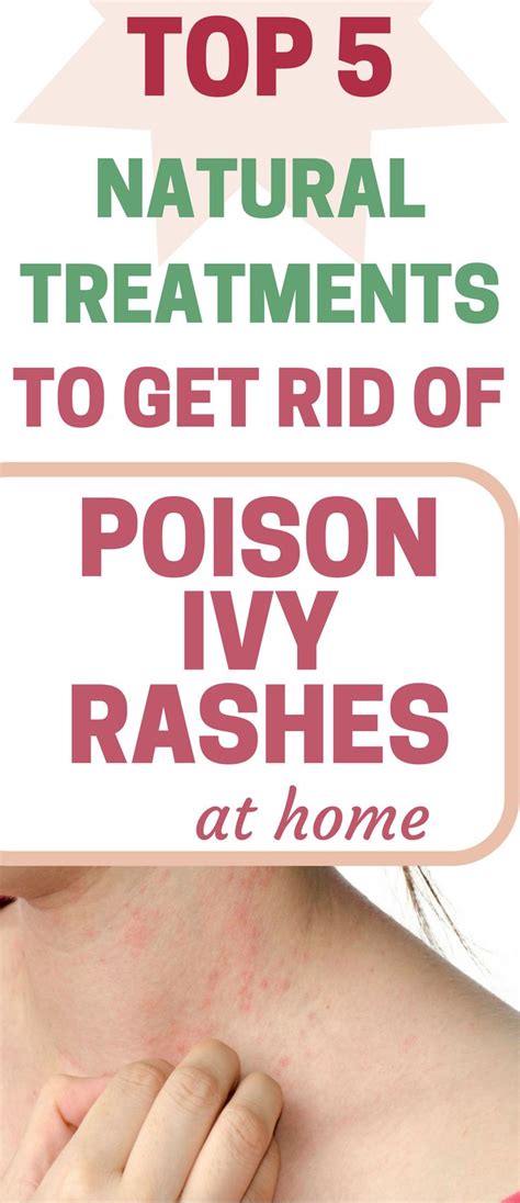 How To Get Rid Poison Ivy Rash