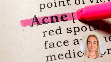 Acne And Mental Health The Eaves