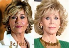 Jane Fonda Plastic Surgery Before and After – Top Celebrity Surgery