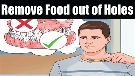Food to eat after wisdom teeth removal. How to Remove Food out of Holes from Extracted Wisdom ...