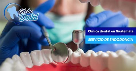Clínica Dental En Guatemala Servicio De Endodoncia