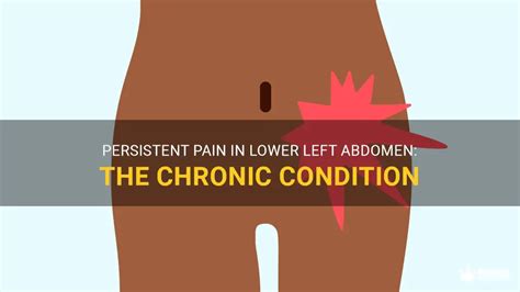 Persistent Pain In Lower Left Abdomen The Chronic Condition MedShun