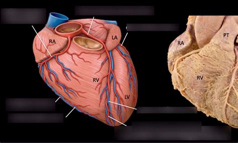 Anterior Coronary Arteries Diagram Quizlet