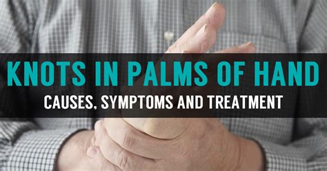 Knots And Lump In Palm Of Hands Symptoms And Home Treatment