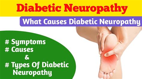 Diabetic Neuropathy What Causes Diabetic Neuropathy Types And