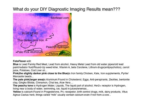 What Do Your Diy Diagnostic Imaging Results Mean