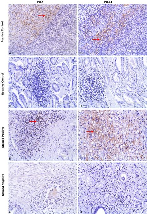 Representative Photomicrographs Of Immunohistochemical Staining Of Pd 1