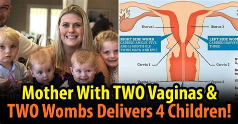 Mother With Two Vaginas And Two Wombs Defies Odds To End Up With Four