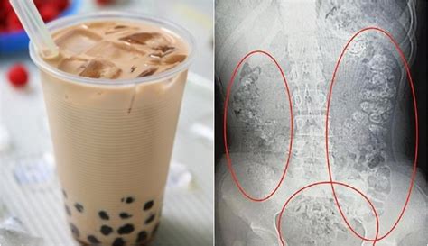  Beredar Minuman Boba 5 Liter, Tinggi Gula tapi Ada yang ...
