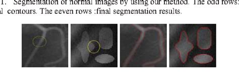 Figure 2 From An Effective Level Set Image Segmentation By Joint Local