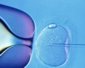 Intra Cytoplasmic Sperm Injection Northeastern Ohio Fertility Center