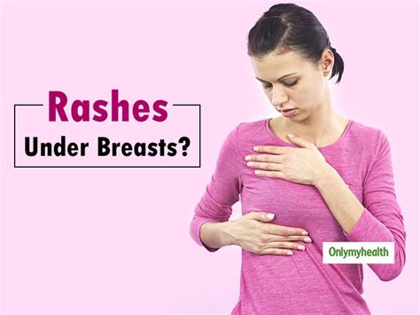 5 Effective Home Remedies For Rashes Under Breasts Onlymyhealth