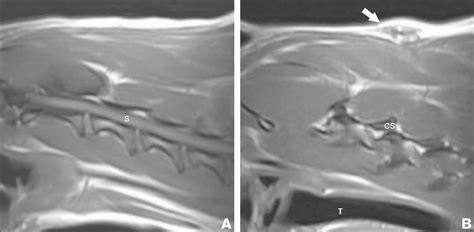 Dermoid Sinus In A 1 Year Old Rhodesian Ridgeback Dog A — Sagittal T 1