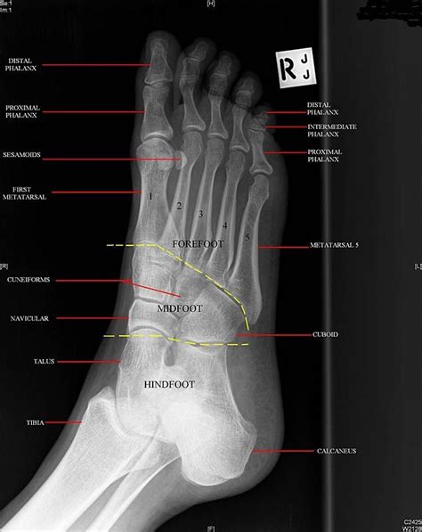 Foot Oblique Unidad Especializada En Ortopedia Y Traumatologia
