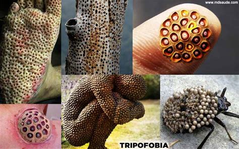 Trypophobia What It Is Main Symptoms And Treatment Syp Studious