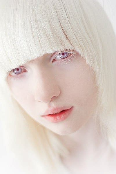Albino With Purple Eyes