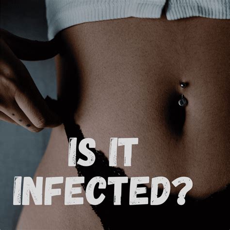 Signs And Treatment Of An Infected Belly Button Piercing 2024