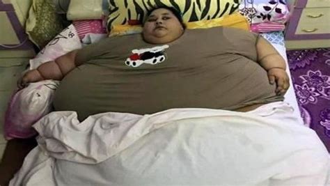 Inde La Femme La Plus Grosse Du Monde Perd 242 Kg Grâce à Une