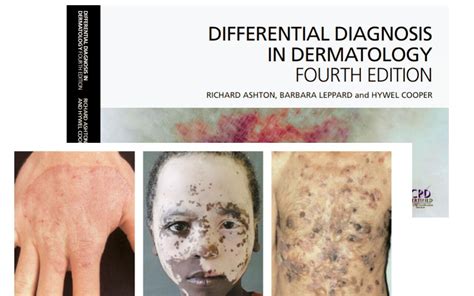 Differential Diagnosis In Dermatology Fourth Edition 4e Pdf Free Ebook