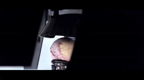 Star Wars Injuries Of Darth Vader