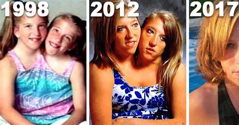 I went into hospital thinking i was going to have one. What Conjoined Twins Abby And Brittany Hensel look Like ...