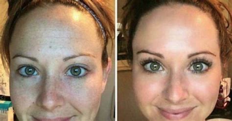 Skin Brightening Before And After ~ Skin Lighter