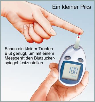 ≥ 100 mg/dl (5,6 mmol/l) Blutzucker - Funktion, Aufbau & Beschwerden | Gesundpedia.de