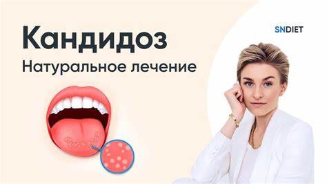 Диета при кандидозе - какие продукты можно употреблять? Картинка - Диета при кандидозе - какие продукты можно употреблять?