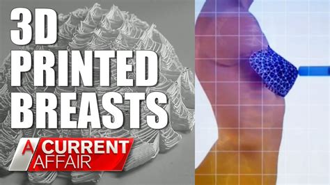 D Printed Breasts Are A Game Changer A Current Affair Australia