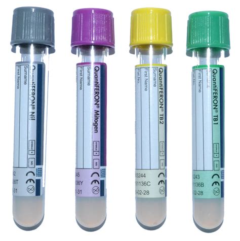 1 nil ha tube, 1 tb1 antigen. CHRU Lille - Pôle Biologie Pathologie Génétique
