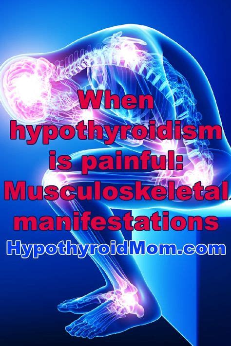 When Hypothyroidism Is Painful Musculoskeletal Manifestations