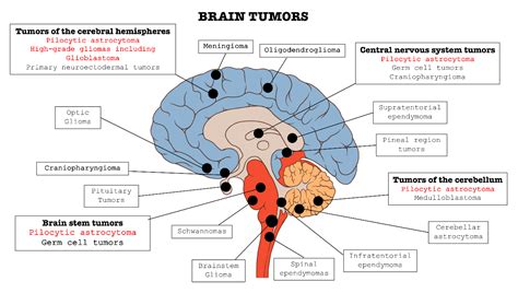 Cancers | Free Full-Text | Role of Fibroblast Growth Factors Receptors