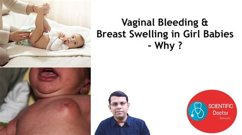 Vaginal Bleeding Breast Swelling In Girl Babies Why Youtube