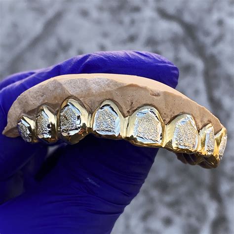 Gold Plated Over 925 Silver Two Tone Diamond Dust Custom Grillz