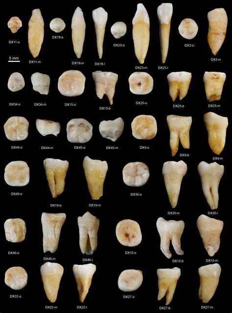 The rest are molars that come in before and during puberty. China fossil teeth discovery reveals humans lived in Asia ...