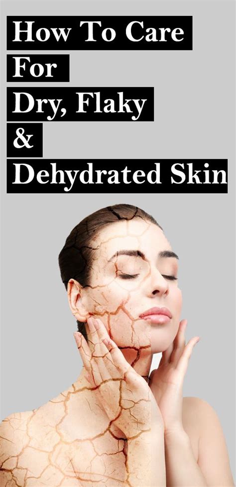 Best Home Remedies To Get Rid Of Dry Skin Cure Dry Skin Artofit