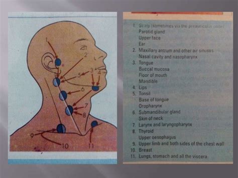 Cervical Lymphadenopathy